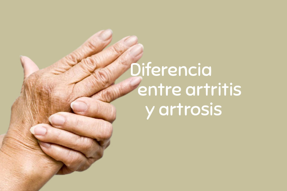 Diferencia entre artritis y artrosis